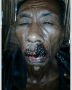 Marthen Taneo(40), korban terkaman buaya di sungai Noelmina 